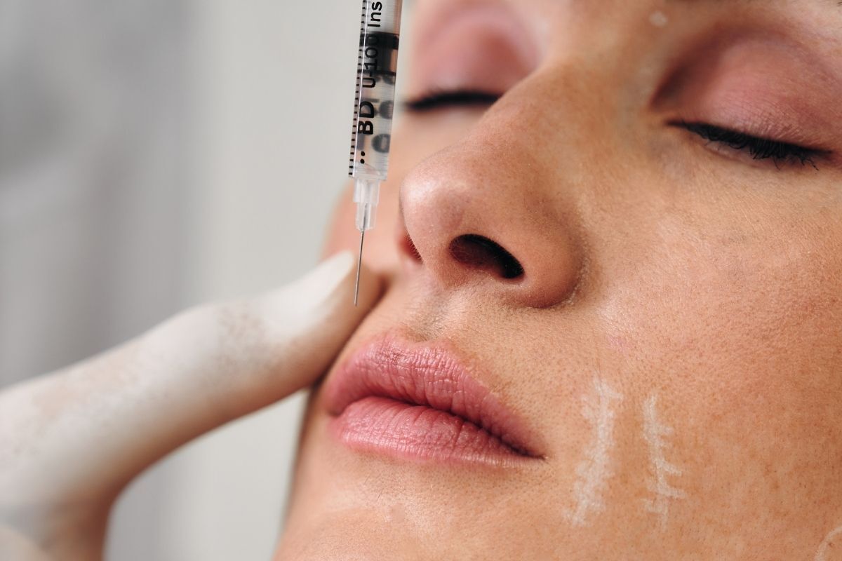 Filler and Botox treatments at The AgeLess Center Atlanta